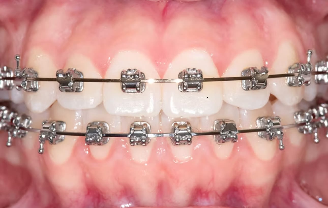 Orthodontic technologies